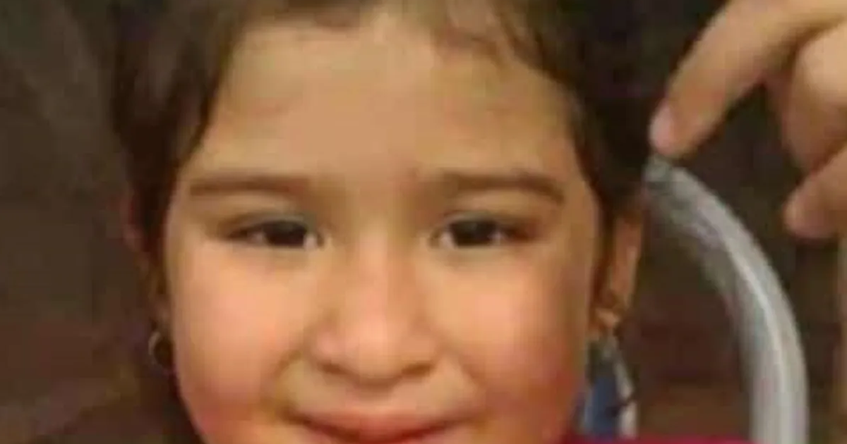 Cómo sigue Franchesca la nena que sufrió graves quemaduras en el