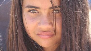 El rostro que despertó la solidaridad de los sanjuaninos