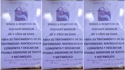 Realizarán un bingo para ayudar a un nene que sufre una enfermedad letal y descartar un síndrome