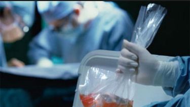 Con una nueva donación de órganos en San Juan, a 9 personas les cambió la vida