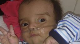 La obra social autorizó la cirugía para Loan, que espera hace 5 meses