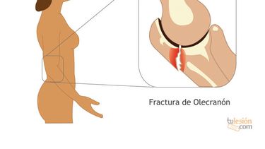Realizaron las primeras cirugías traumatológicas en el Marcial Quiroga