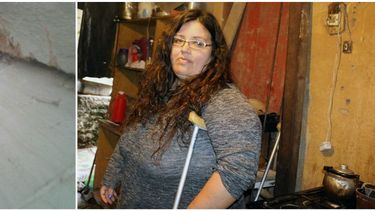 Vive con 7 niños, no puede caminar bien y se le partió una pared por el sismo