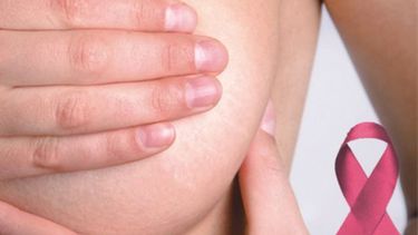 Consejos para prevenir el cáncer de mama