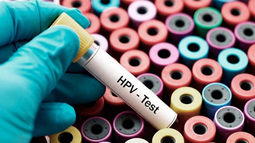 En 2023 se diagnosticaron en San Juan casi 50 casos de Cáncer de Cuello Uterino