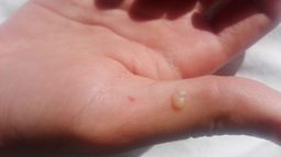 Por testear un circuito para “aprobar”, un chico recibió una descarga eléctrica en la Boero