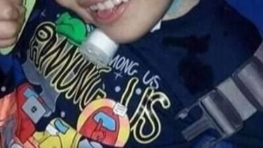 Sanjuanino de 8 años padece encefalopatía y contrajo Covid-19: está en estado crítico