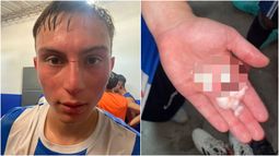 Reclamaron por una serie de agresiones y robos tras un partido de la B Local en Pocito Reclamaron por una serie de agresiones y robos tras un partido de la B Local en Pocito