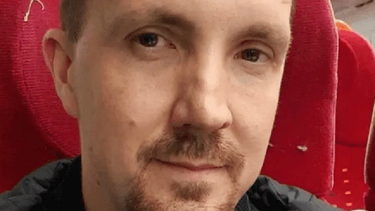 ¡Chanfles!: dice que la imagen de Jesús apareció en su moretón, mirá