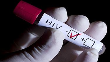 Testeos masivos de HIV en la UNSJ