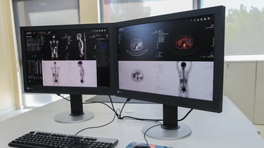 Cómo son los estudios del Tomógrafo PET/CT en San Juan y porqué el tiempo es un factor determinante
