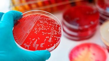 San Juan está entre las que menos problemas de superbacterias tiene