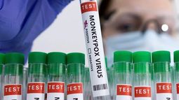 Ya hay 14.178 casos notificados de personas con viruela del mono&nbsp;en 68 países