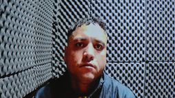 Prestamista al que golpearon de un ladrillazo en Chimbas: el agresor seguirá preso a pesar de la insistencia de la defensa Prestamista al que golpearon de un ladrillazo en Chimbas: el agresor seguirá preso a pesar de la insistencia de la defensa