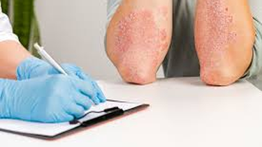 El Hospital Rawson y una campaña gratuita para conocer más sobre psoriasis