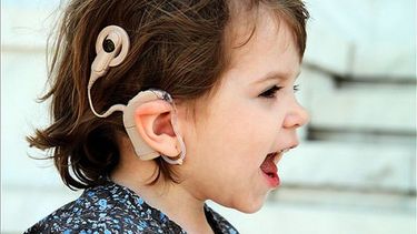 San Juan, entre las provincias con mayor cantidad de implantes cocleares