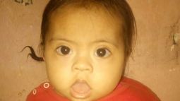 Tiene Síndrome de Down, la operaron del corazón y su mamá necesita ayuda para alimentarla