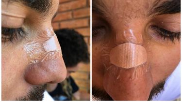 Denuncian que rugbiers mendocinos golpearon a un sanjuanino en Reñaca