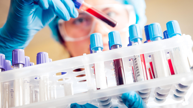 Otro sector de la salud en alerta: bioquímicos podrían dejar de recibir obras sociales