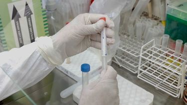 Real time, 19 bioquímicos y 18 horas clave: ¿Cómo se hacen los “coronatest” en San Juan?