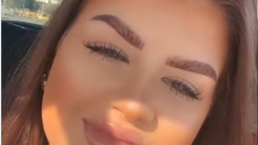 Impactante imagen: un tratamiento estético falló y su cara quedó deformada