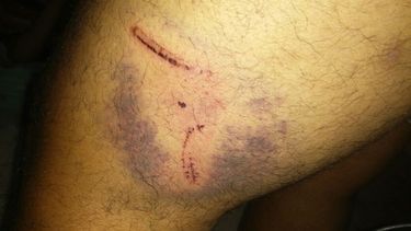 Santa Lucía: Denuncian a perro que ataca a vecinos y nadie hace nada