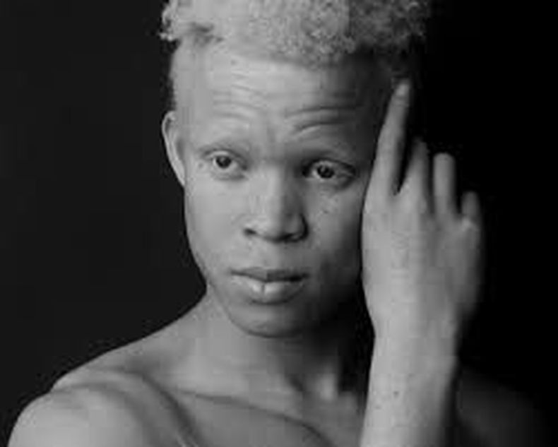 modelo albino africano