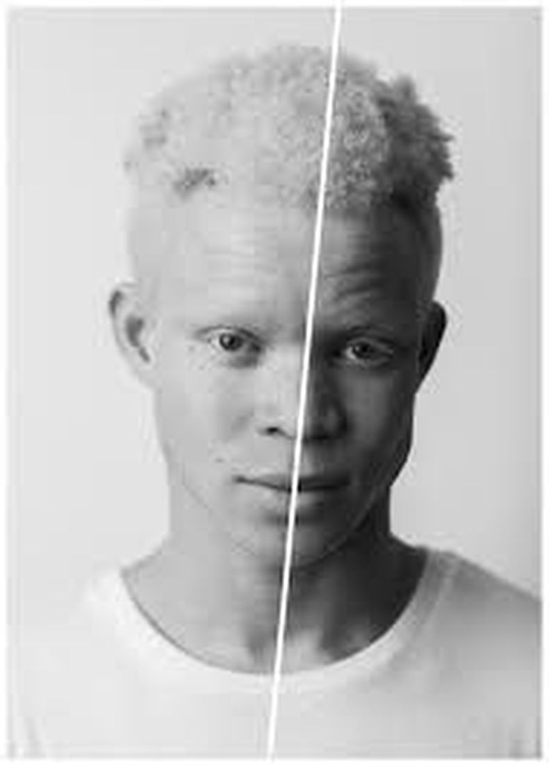 modelo albino africano