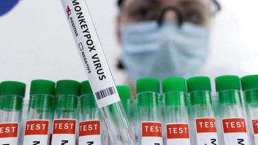 Estados Unidos, muy cerca de declarar la emergencia sanitaria por la viruela del mono