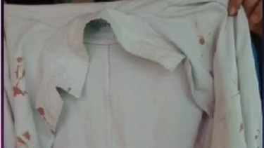 Una mamá denunció un terrible caso de bullying en una escuela de Caucete