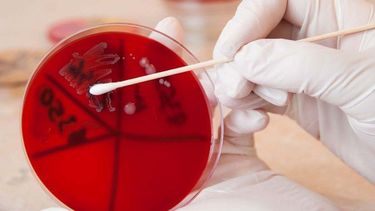 ¿Cuáles son los síntomas de la meningitis?