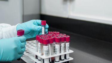 Bioquímicos empezaron a cobrar un plus de $3000 a los usuarios de casi todas las prepagas