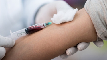 En Capital realizarán exámenes gratuitos de próstata.