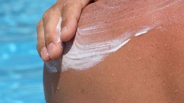 Lo que tenés que saber a la hora de tomar sol