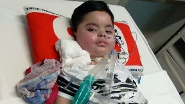 Tras meses de lucha, llegó el día en que el sanjuaninito Liam empezó a renacer