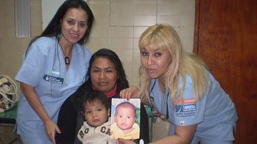 Las cirugías reconstructivas que cambian vidas