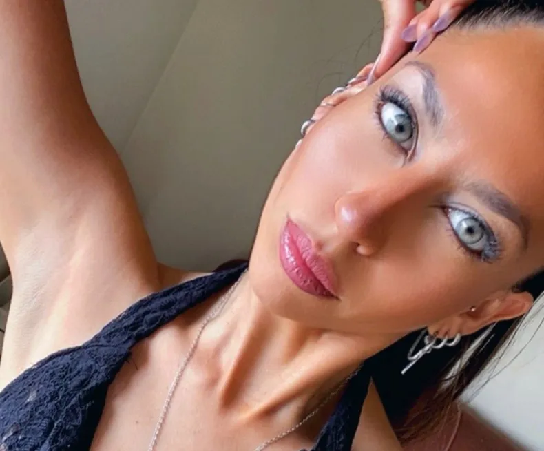 Esta es Evelyn Esquivel, la accidentada.