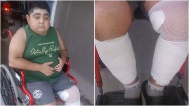 Niño tiene una grave enfermedad: gastan más de $80.000 por mes en una crema
