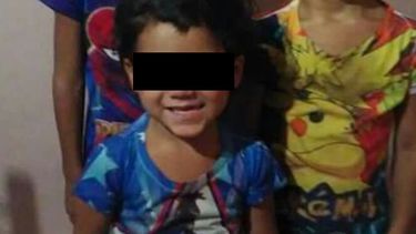 Continúa grave y sin avances el pequeño quemado en un incendio Continúa grave y sin avances el pequeño quemado en un incendio