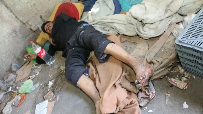 Vive en la calle y lleva días gritando de dolor sin recibir ayuda