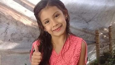 El milagro de Brisa, la nena que se quemó la mitad de su cuerpo