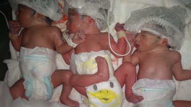 ¡La partera dijo “trillizos”! Una pareja de sanjuaninos dio a luz a tres bebés ¡La partera dijo “trillizos”! Una pareja de sanjuaninos dio a luz a tres bebés