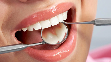 Cinco tips de una odontóloga sanjuanina para prevenir el cáncer bucal