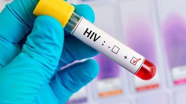 VIH: en San Juan, el 80% de los diagnosticados son hombres