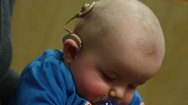 Con 11 meses, es la más pequeña en recibir un doble implante coclear