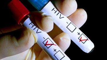 Infectología: jornada de actualización en HIV