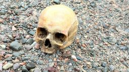 Hallaron un cráneo humano en el Dique Punta Negra e investigan una presunta brujería Hallaron un cráneo humano en el Dique Punta Negra e investigan una presunta brujería