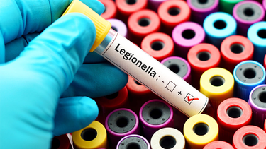 ¿Qué probabilidades hay de que la bacteria que mata en Tucumán llegue a San Juan?