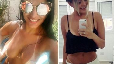 La “marquinha”, los peligros del bronceado de moda