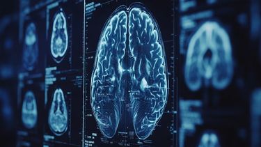 Encuentran un vínculo entre las bacterias de la boca y el Parkinson